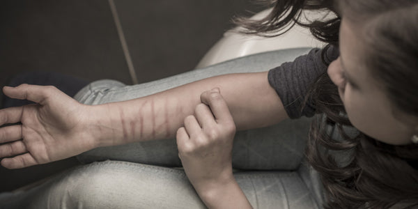 Menina com cicatrizes nos braços