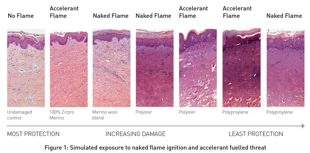 Naked Flame exposure