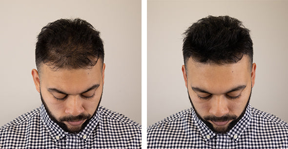 Hair Fibers Before/After