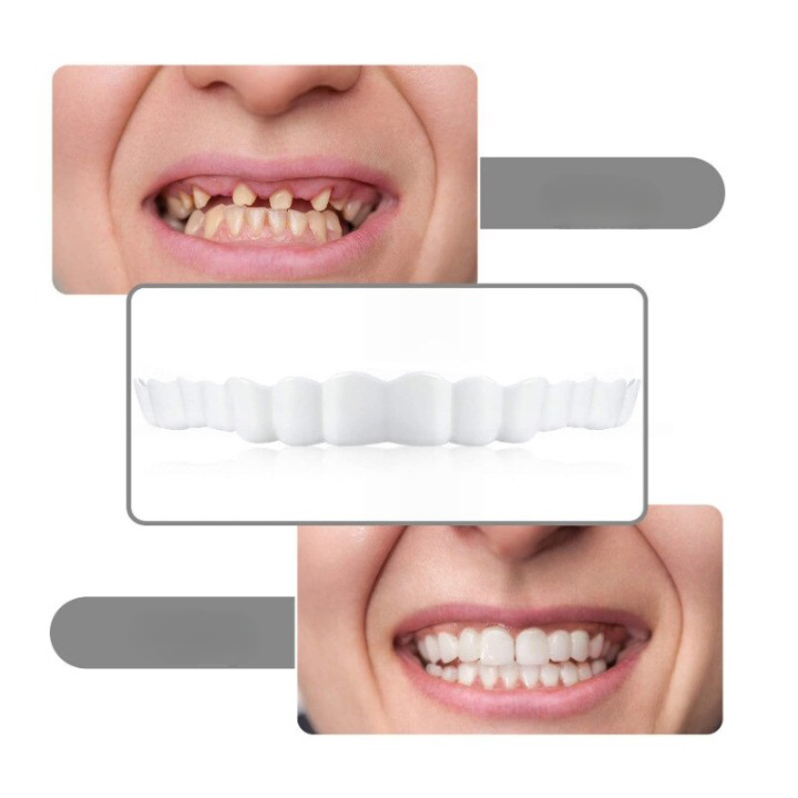 Perfektes Gebiss™ | Keine Sorgen über schlechte Zähne | 1 + 1 FREI