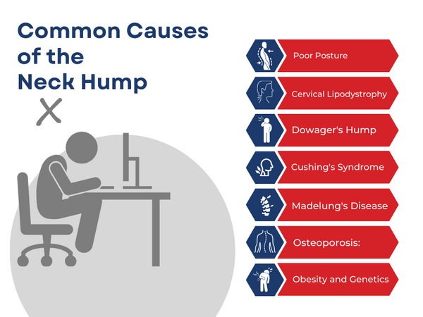 Neck hump causes