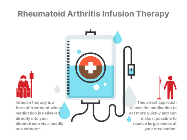 rheumatoid arthritis infusion therapy