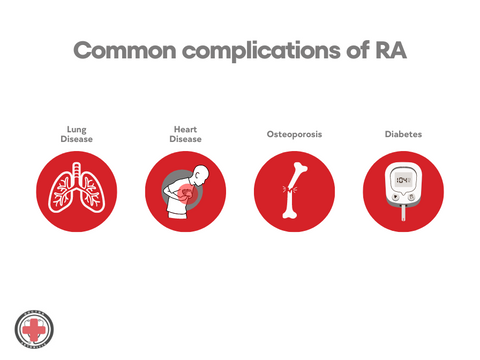 rheumatism vs arthritis - symptoms