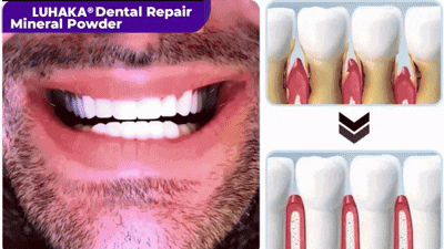 LUHAKA® Dental Repair Mineral Powder
