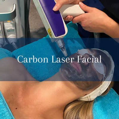 Carbon Laser Facial