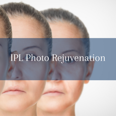 IPL Photo rejuvenation