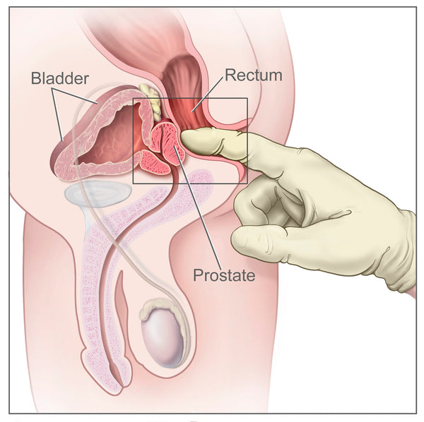 Prostate Massage