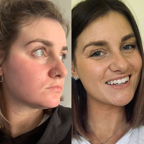 Brooke Real Results Before and After with esmi Skin Minerals