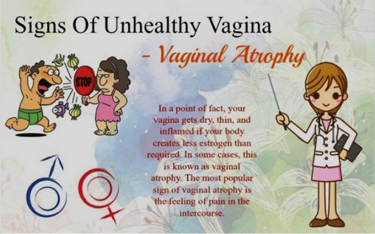 Signs of Unhealthy Vagina