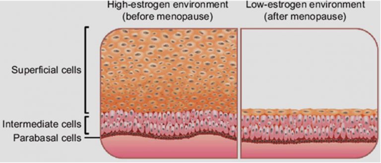 Left: Multiple layered vaginal lining superficial cells peel off daily to remove attached bacteria. Right: after menopause, only 1 layer of superficial cells remains and surface cell peeling stops and bacteria attached to the skin surface are not removed naturally.