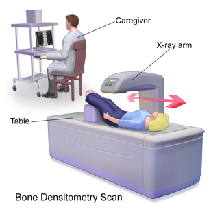 Bone Densitometry Scan