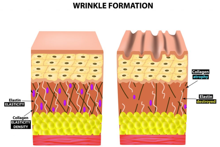 Wrinkle Formation