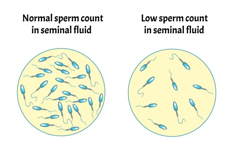 Sperm Concentration_test_Hangzhou_medasia_group.jpg__PID:29cfb632-4a58-4b94-8d22-6382c39de601