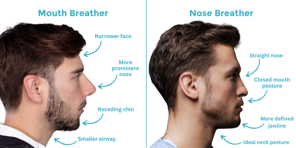 Nose breathing vs mouth breather diagram dryft sleep
