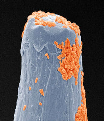 Contamination on the end of an injection needle.