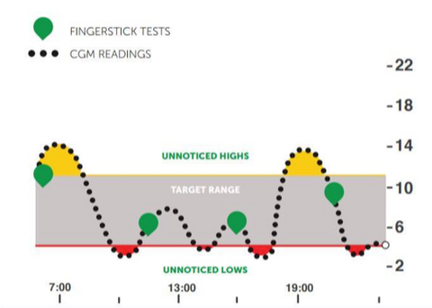 A continuous glucose monitor graph showing blood sugar highs and lows.