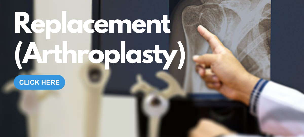 replacement arthroplasty click here for patient education information dr reza jazayeri md