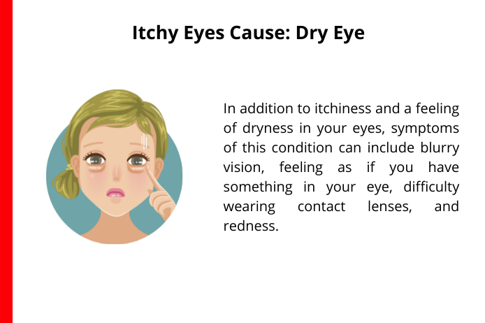 dry eye as a common cause for itchy eyes