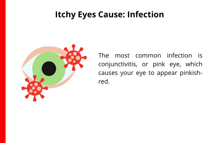 infection can cause itchy eyes