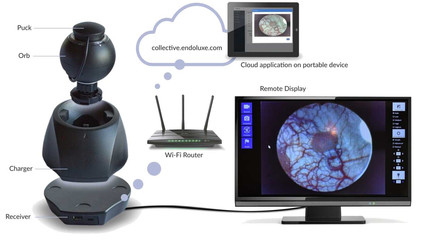 Endoluxe eVS Wireless Visualization System Full Configuration