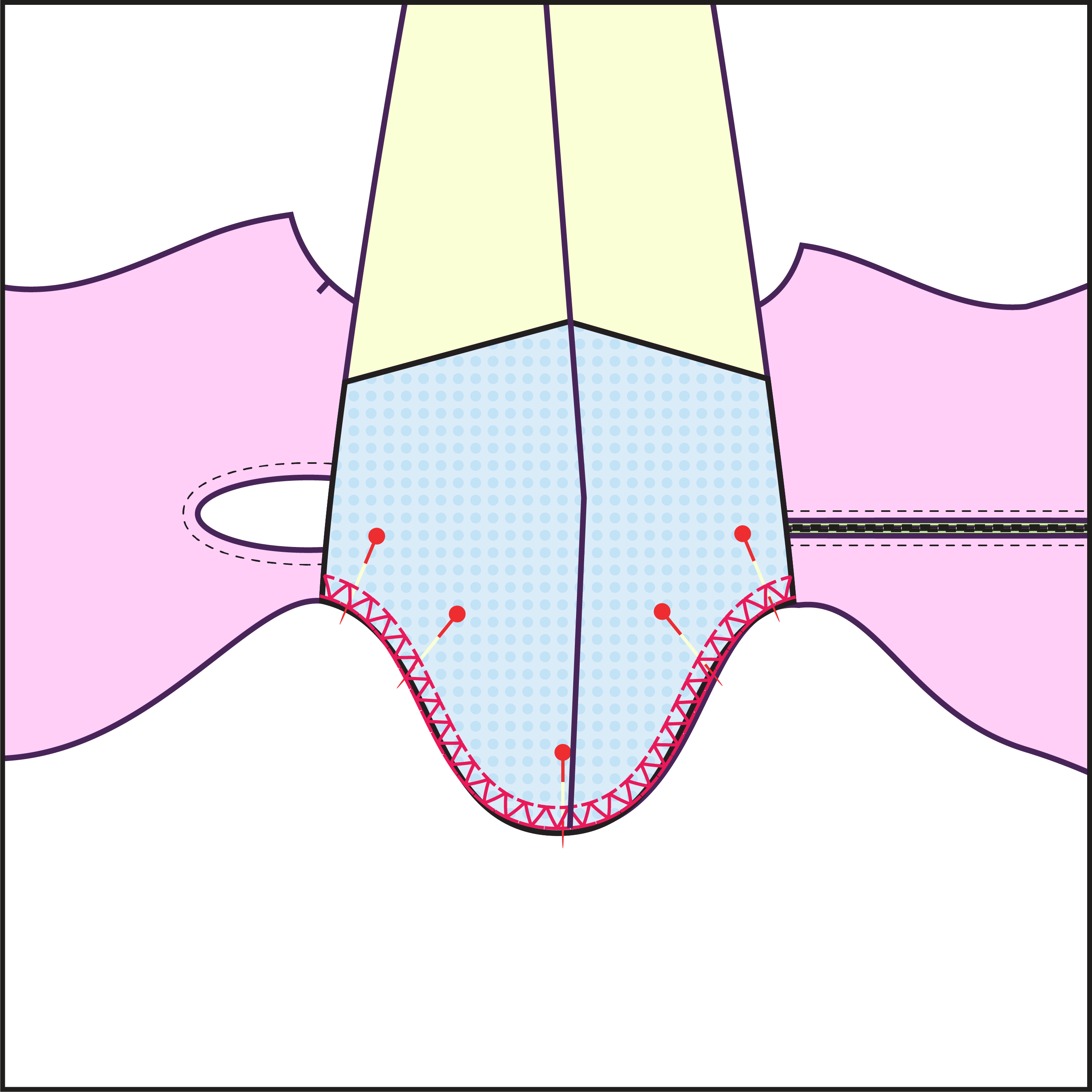 Step 15 How to sew a power shoulder sleeve leotard sewing pattern for drag queens