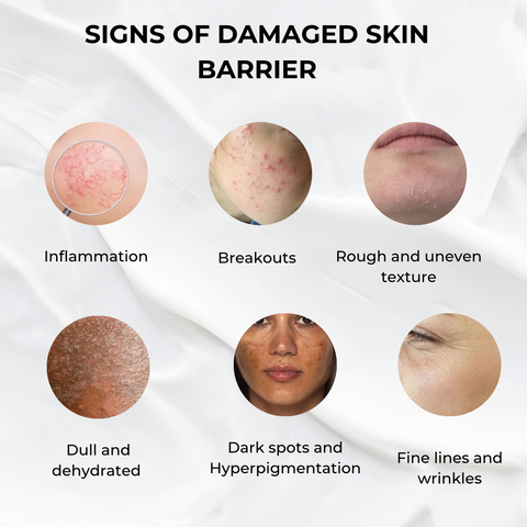 Skin barrier support