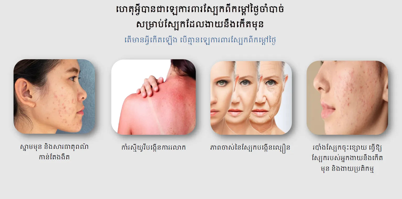 ហេតុអ្វីបានជាឡេការពារស្បែកពីកម្តៅថ្ងៃពិតជាចាំបាច់ ឬមិនអាចរំលងបានសម្រាប់ស្បែកងាយនឹងកើតមុន?