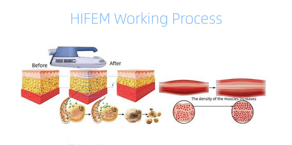 HIFEM Working Process