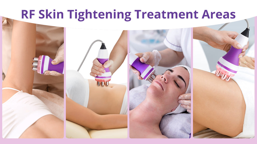 radio frequency skin tightening treatment area