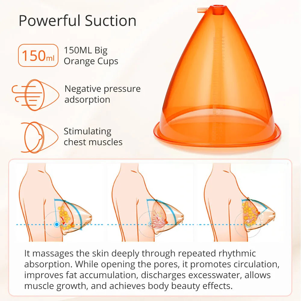 Cosmas Cup for Breast Positioning - Size B (Qty. 5) - Radiation