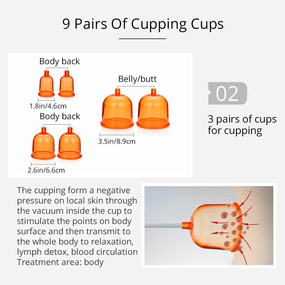 Cupping Therapy: Does Cup Size and Shape Matter? - AcuPrime