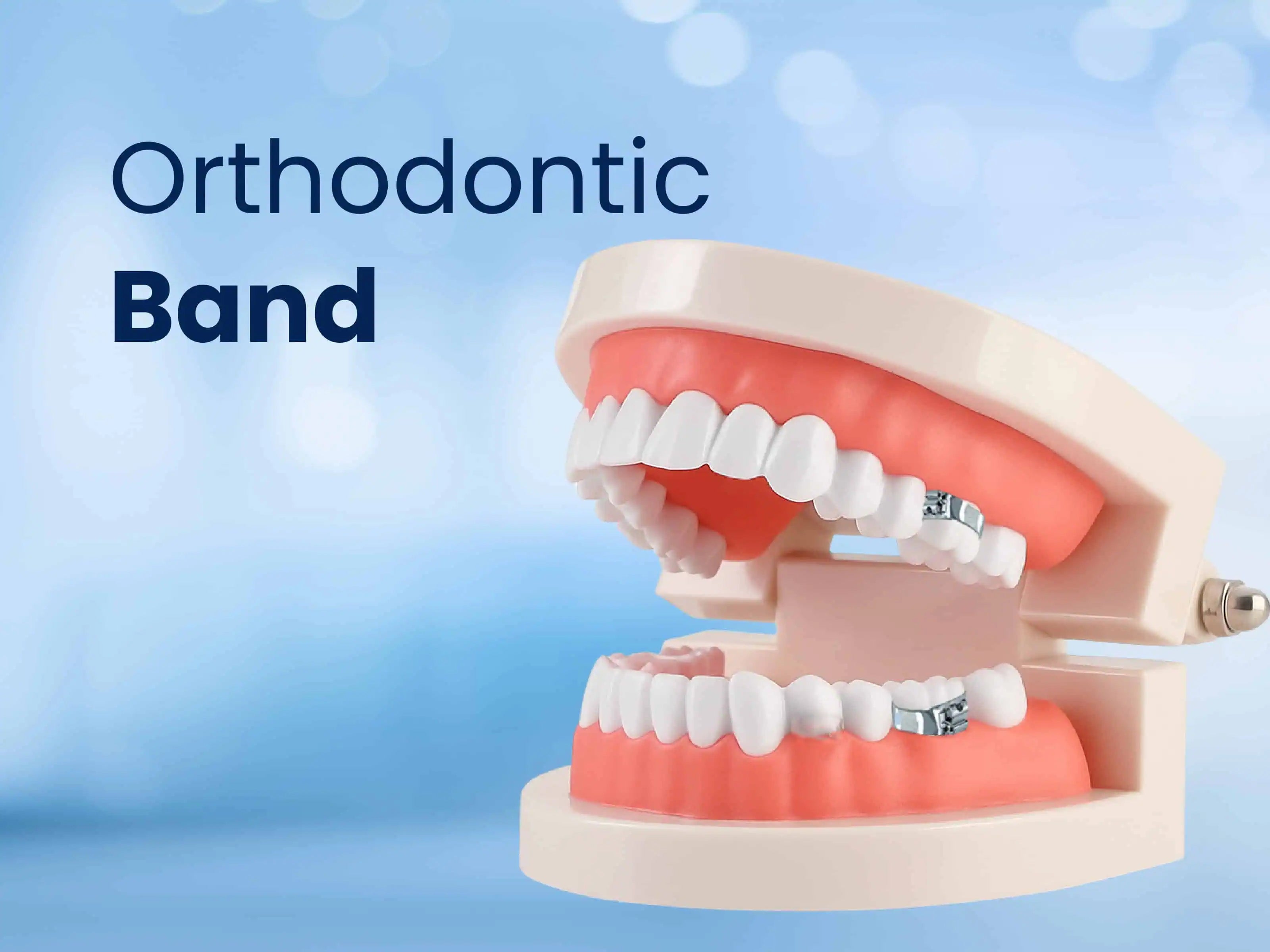 Band Material in Orthodontics
