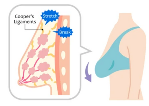 LiftUp Microcurrent BreastPlump Massager