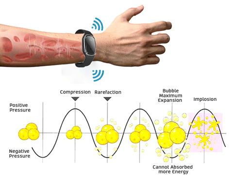 Ultrasonic Ultra-Tech Body Shape Wristband