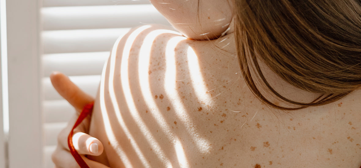 Woman with long brown hair and a freckly back, looking over her bare shoulder.