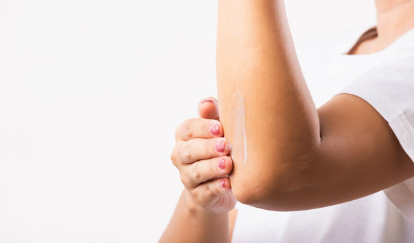 A woman rubbing a CBD Salve on her elbow