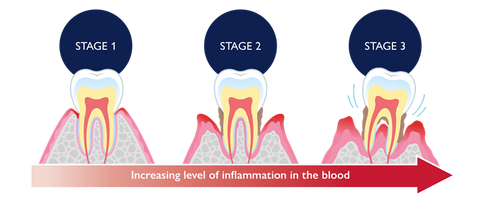 Teethyouth Tooth Regrowth Gel 