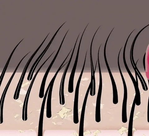 A Escova Massageadora De Couro Cabeludo Shampoo Brush Ricca é boa e limpa profundamente o couro cabeludo ao mesmo tempo que massageia. Lavar os fios Lavar apenas com a mão não retira todos os resíduos de produtos, sujeira, poluição, fungos e bactérias. A escova massageadora do couro cabeludo auxilia na limpeza completa do cabelo, como tratar caspa no couro cabeludo. Além disso, melhora a queda de cabelo, estimula os vasos sanguíneos do couro cabeludo fazendo com que o seu cabelo cresça mais rápido e mais forte. Elimina ainda a caspa e deixa os fios mais soltinhos, limpos e macios.