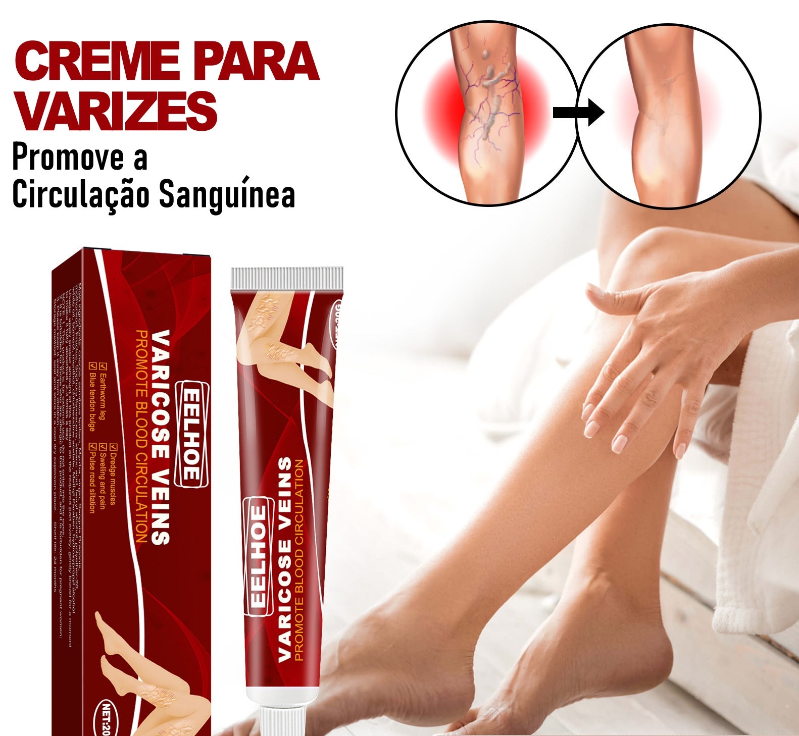 Varicose veins - ELIMINE POR COMPLETO VARIZES, VASINHOS E INCHAÇOS!