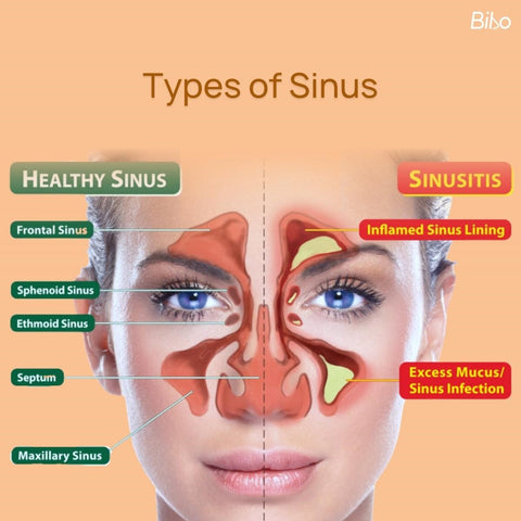 Types of Sinuses