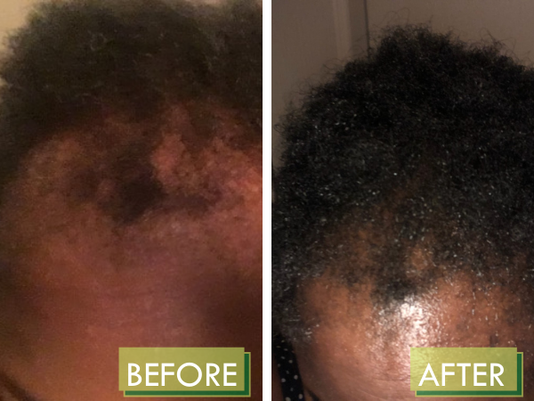 MAKEBA | HOPE RENEWED Scalp & Hair Treatment - 8oz – Makeba