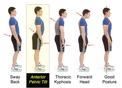 Correct Pelvis Postures