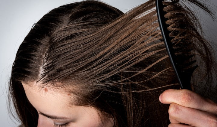 7 Reasons Why Hair Gets Greasy So Fast and What Can You Do About It   Bright Side