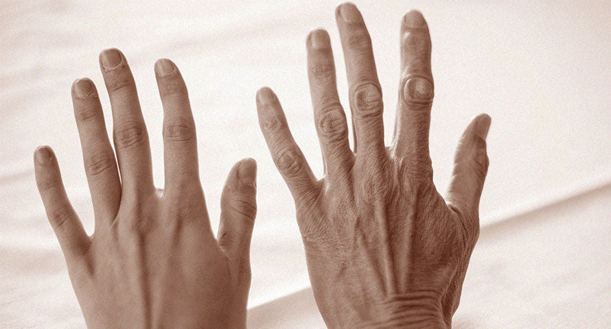Close-up image of aged hands, showcasing the natural signs of skin aging with visible wrinkles and spots