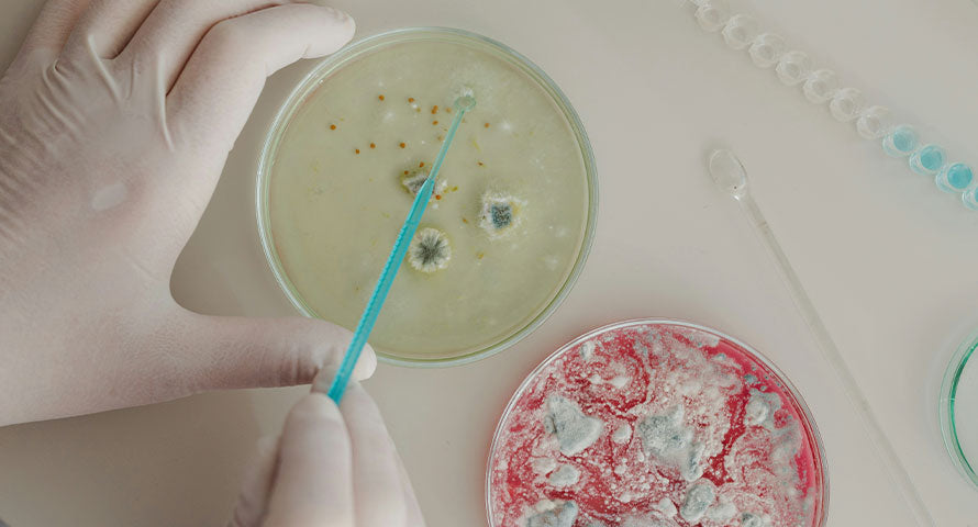 Image of two Petri dishes containing visible bacterial colonies. Each dish shows different patterns and colors of growth, representing microbial cultures in a laboratory setting.