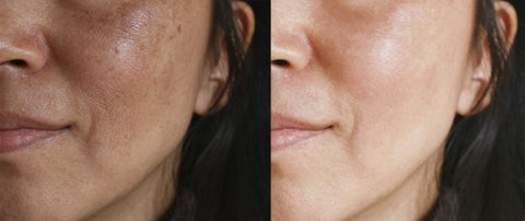 Before and After image of Zo Skin health product usage test