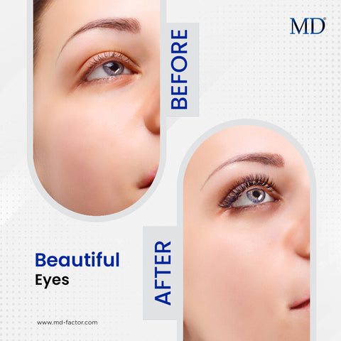 Results MD lash Factor - MD