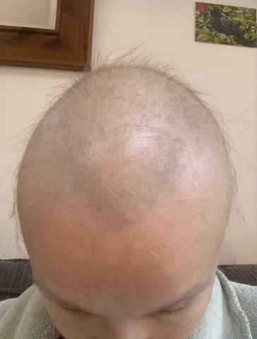 carolines-hair-post-chemo