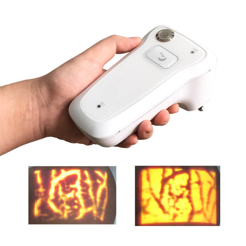 Aimvein portable vein finder image