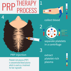 PRP Hair Restoration